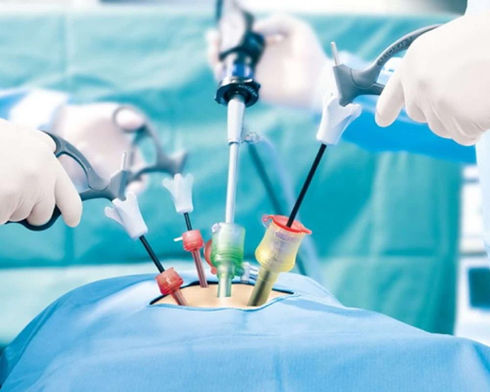 Laparoscopic Surgery